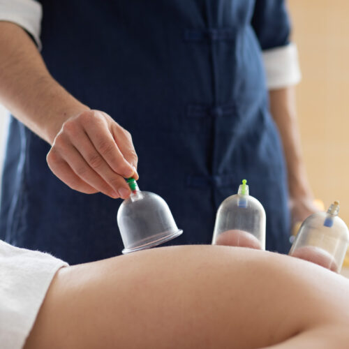 Service images-03 Cupping Therapy
