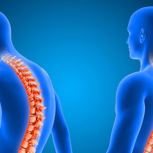 Untitled-1-03 Postural Correction Therapy