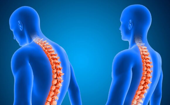 Postural Correction Therapy